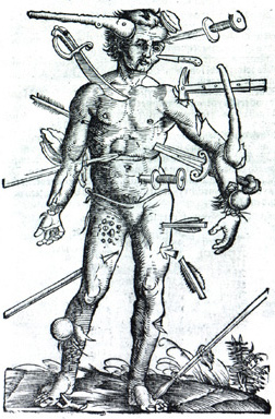 Wound Man